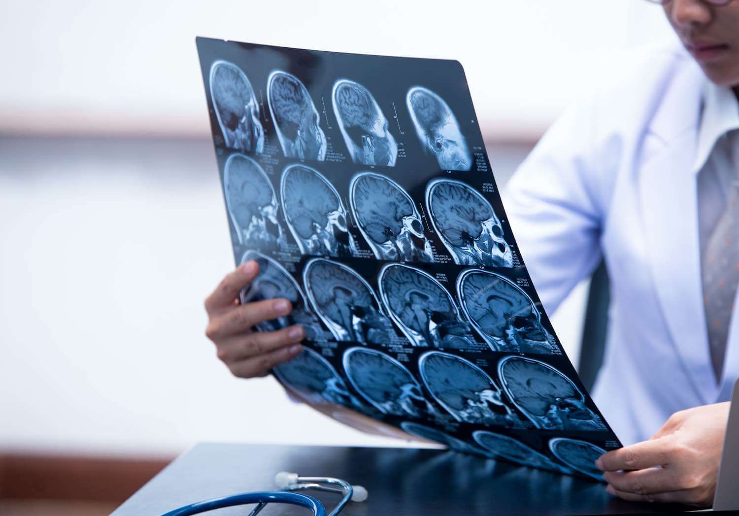 Neurologia a Vicenza: Diagnosi, Cura e Riabilitazione al Centro Medico Rindola
