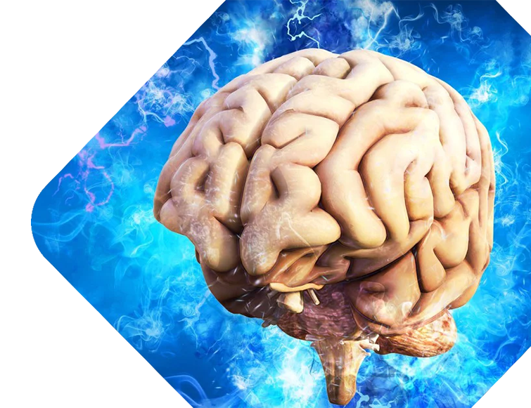 error-pagebrain-img-1